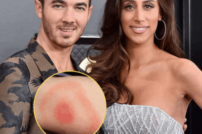 Danielle Jonas, wife of Kevin Jonas, has revealed she’s been privately battling Lyme disease. The TV personality shared that her diagnosis came only after doctors initially dismissed her symptoms, leaving her struggling for answers. Now, she’s opening up about the journey — and the importance of trusting your own body when something feels wrong.