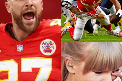 Travis Kelce just broke the illusion of perfection. 🏈 He posted a raw photo of his bruised legs after a grueling game, captioned simply: “Pay the price.” Within hours, fans were dissecting every mark — some praising his honesty, others warning he’s pushing too hard. But in a world obsessed with highlight reels and spotless victory, Kelce’s post hit different — a bruised reminder of what greatness really costs.